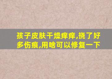 孩子皮肤干燥痒痒,挠了好多伤痕,用啥可以修复一下