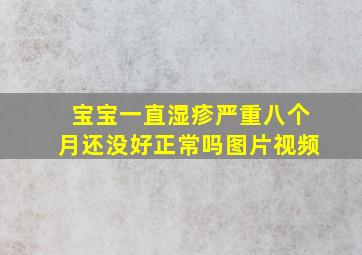 宝宝一直湿疹严重八个月还没好正常吗图片视频