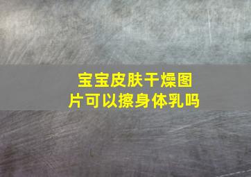 宝宝皮肤干燥图片可以擦身体乳吗