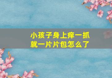 小孩子身上痒一抓就一片片包怎么了