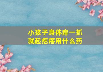 小孩子身体痒一抓就起疙瘩用什么药