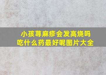 小孩荨麻疹会发高烧吗吃什么药最好呢图片大全