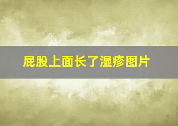 屁股上面长了湿疹图片