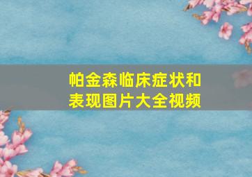 帕金森临床症状和表现图片大全视频