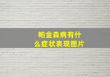 帕金森病有什么症状表现图片