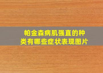 帕金森病肌强直的种类有哪些症状表现图片