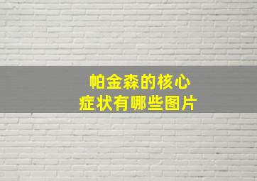 帕金森的核心症状有哪些图片