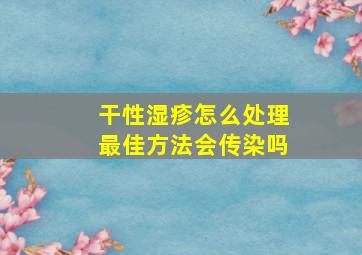 干性湿疹怎么处理最佳方法会传染吗