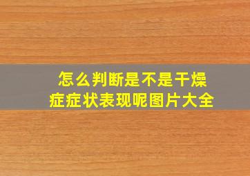 怎么判断是不是干燥症症状表现呢图片大全