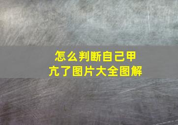 怎么判断自己甲亢了图片大全图解