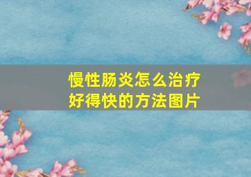 慢性肠炎怎么治疗好得快的方法图片