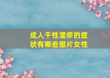 成人干性湿疹的症状有哪些图片女性