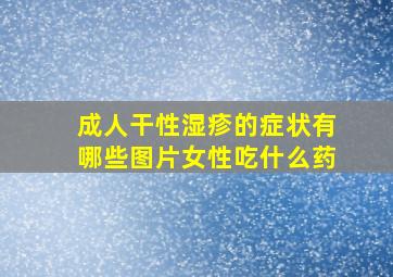 成人干性湿疹的症状有哪些图片女性吃什么药