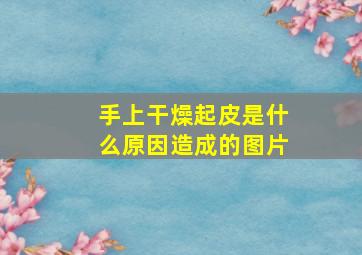 手上干燥起皮是什么原因造成的图片