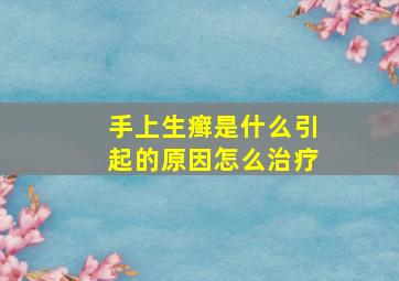 手上生癣是什么引起的原因怎么治疗