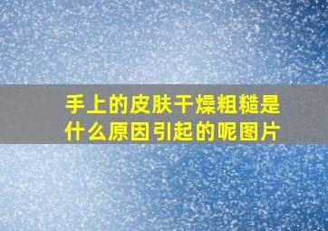 手上的皮肤干燥粗糙是什么原因引起的呢图片