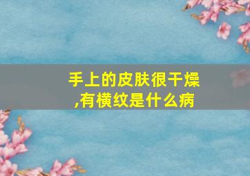 手上的皮肤很干燥,有横纹是什么病