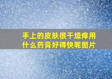 手上的皮肤很干燥痒用什么药膏好得快呢图片