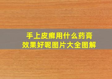 手上皮癣用什么药膏效果好呢图片大全图解