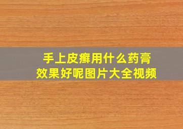 手上皮癣用什么药膏效果好呢图片大全视频