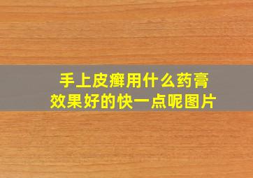 手上皮癣用什么药膏效果好的快一点呢图片