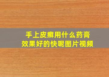 手上皮癣用什么药膏效果好的快呢图片视频