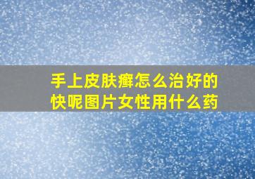 手上皮肤癣怎么治好的快呢图片女性用什么药