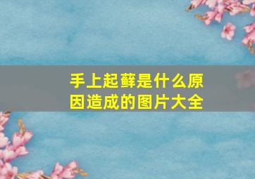 手上起藓是什么原因造成的图片大全