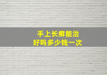 手上长癣能治好吗多少钱一次