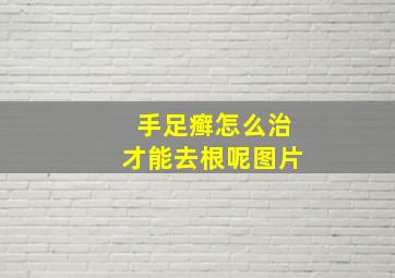 手足癣怎么治才能去根呢图片