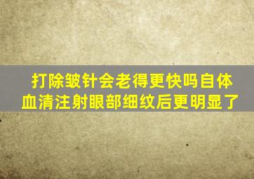 打除皱针会老得更快吗自体血清注射眼部细纹后更明显了