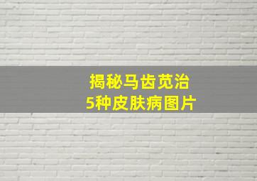 揭秘马齿苋治5种皮肤病图片