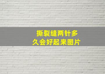 撕裂缝两针多久会好起来图片