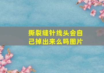 撕裂缝针线头会自己掉出来么吗图片