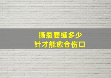 撕裂要缝多少针才能愈合伤口