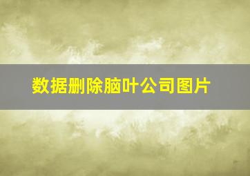 数据删除脑叶公司图片