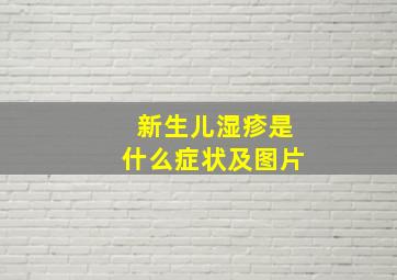 新生儿湿疹是什么症状及图片