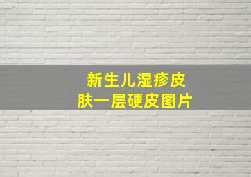 新生儿湿疹皮肤一层硬皮图片