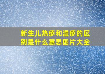 新生儿热疹和湿疹的区别是什么意思图片大全