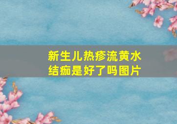 新生儿热疹流黄水结痂是好了吗图片