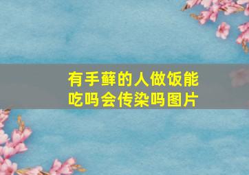 有手藓的人做饭能吃吗会传染吗图片