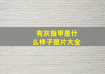 有灰指甲是什么样子图片大全