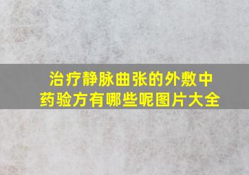 治疗静脉曲张的外敷中药验方有哪些呢图片大全