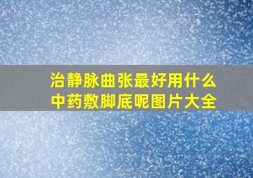 治静脉曲张最好用什么中药敷脚底呢图片大全