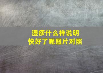 湿疹什么样说明快好了呢图片对照