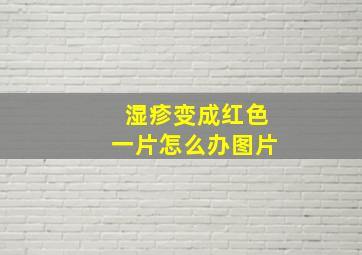 湿疹变成红色一片怎么办图片