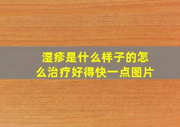 湿疹是什么样子的怎么治疗好得快一点图片