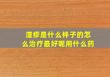 湿疹是什么样子的怎么治疗最好呢用什么药