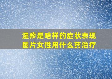 湿疹是啥样的症状表现图片女性用什么药治疗