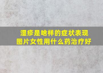 湿疹是啥样的症状表现图片女性用什么药治疗好